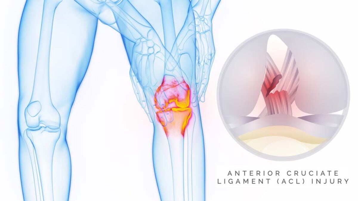 Kstovoda yalangoch qizlarning fotosuratlari