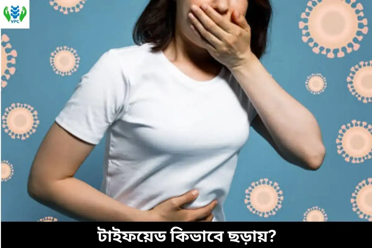 টাইফয়েড কিভাবে ছড়ায়