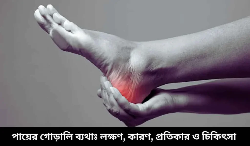 পায়ের গোড়ালি ব্যথা- লক্ষণ, কারণ, প্রতিকার ও চিকিৎসা