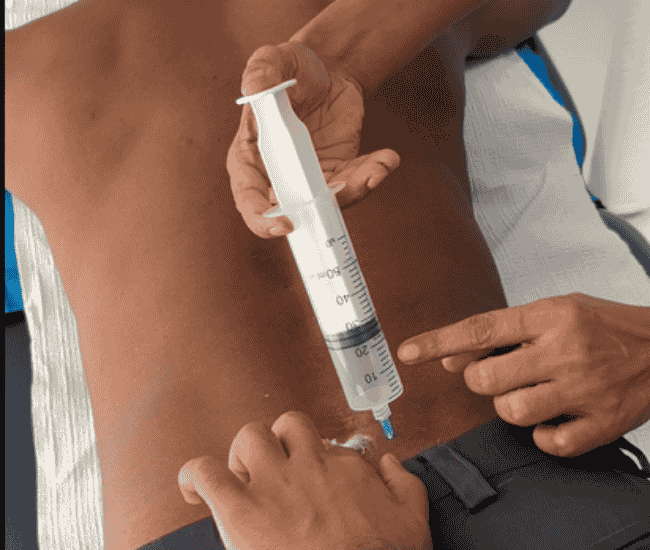 back-ozone
