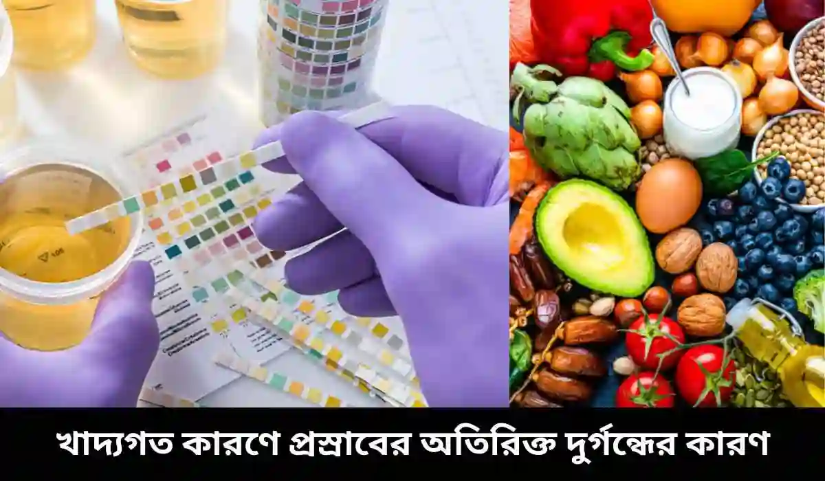 খাদ্যগত কারণে প্রস্রাবের অতিরিক্ত দুর্গন্ধের কারণ
