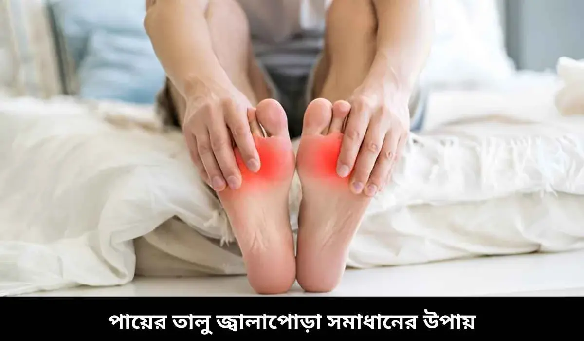 পায়ের তালু জ্বালাপোড়া সমাধানের উপায়