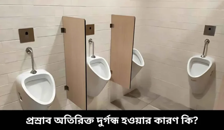 প্রস্রাব অতিরিক্ত দুর্গন্ধ হওয়ার কারণ কি