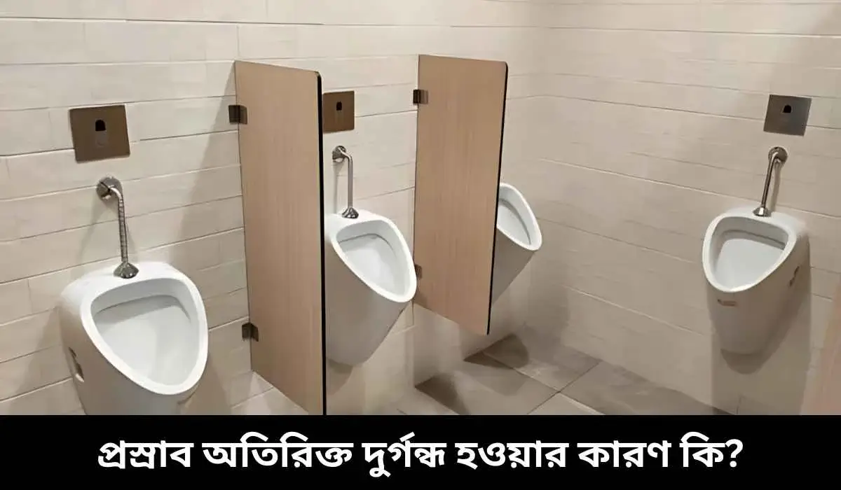 প্রস্রাব অতিরিক্ত দুর্গন্ধ হওয়ার কারণ কি