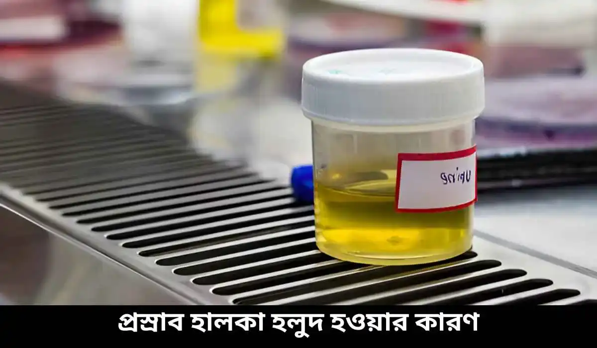 প্রস্রাব হালকা হলুদ হওয়ার কারণ