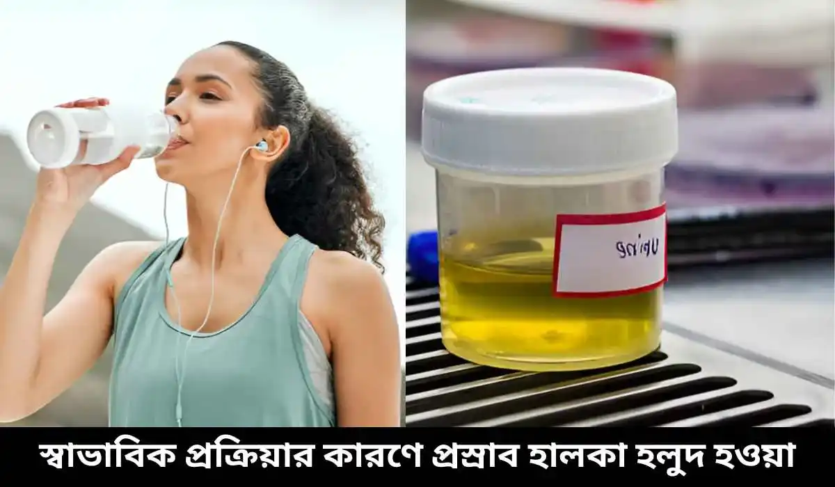 স্বাভাবিক প্রক্রিয়ার কারণে প্রস্রাব হালকা হলুদ হওয়া
