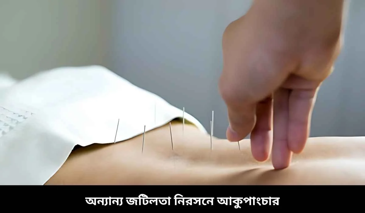 অন্যান্য জটিলতা নিরসনে আকুপাংচার