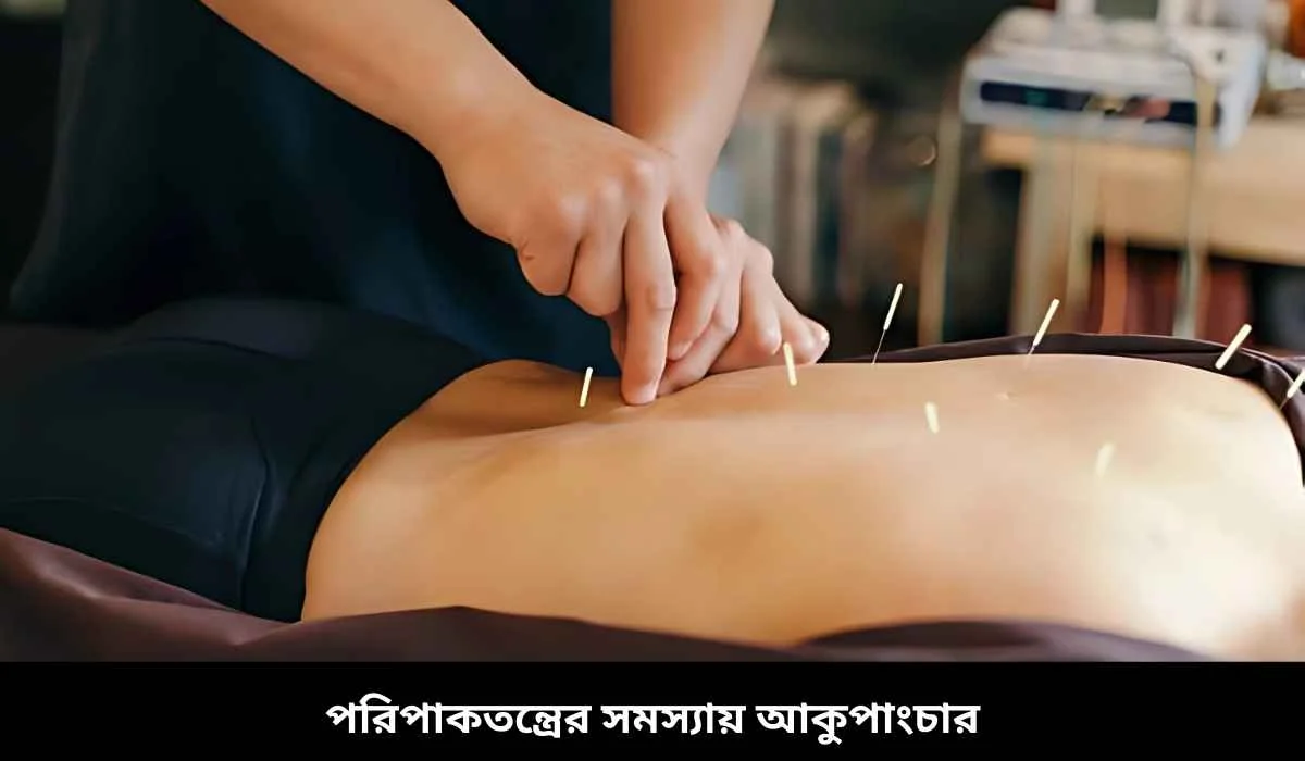 পরিপাকতন্ত্রের সমস্যায় আকুপাংচার
