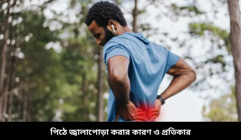 পিঠে জ্বালাপোড়া করার কারণ ও প্রতিকার