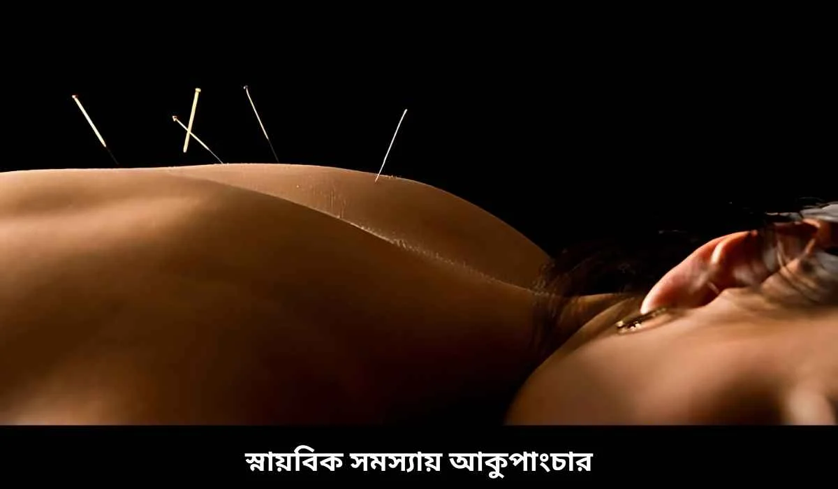 স্নায়বিক সমস্যায় আকুপাংচার