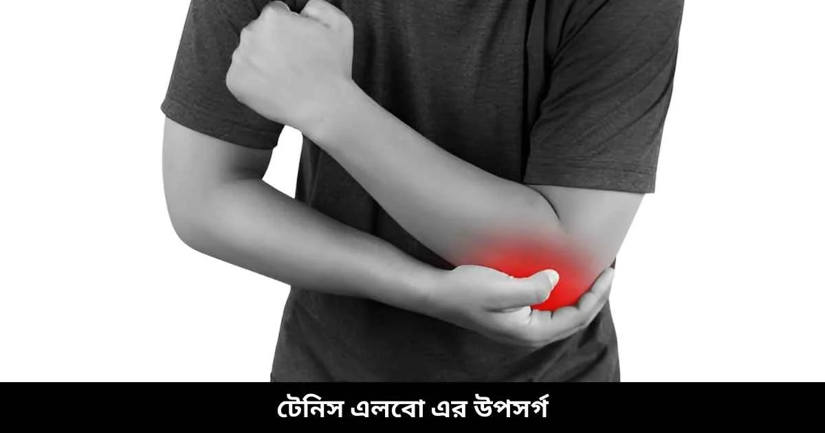 টেনিস এলবো এর উপসর্গ