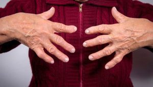 Rheumatoid Arthritis Treatment In Bangladesh