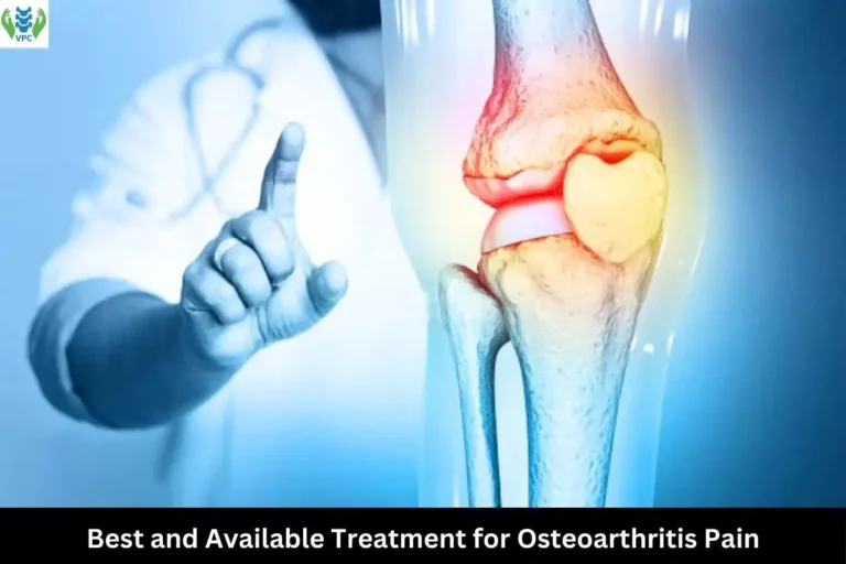 Best treatment for osteoarthritis pain