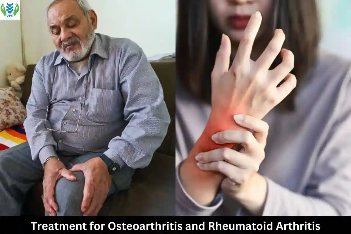 Treatment for osteoarthritis and rheumatoid arthritis