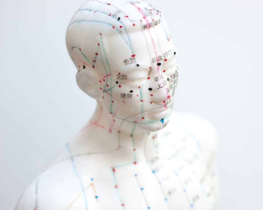 What Is Acupuncture Treatment Complete Details