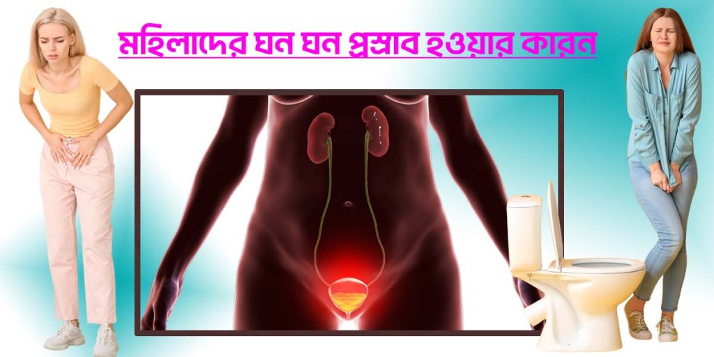 মহিলাদের ঘন ঘন প্রস্রাব হওয়ার কারণ