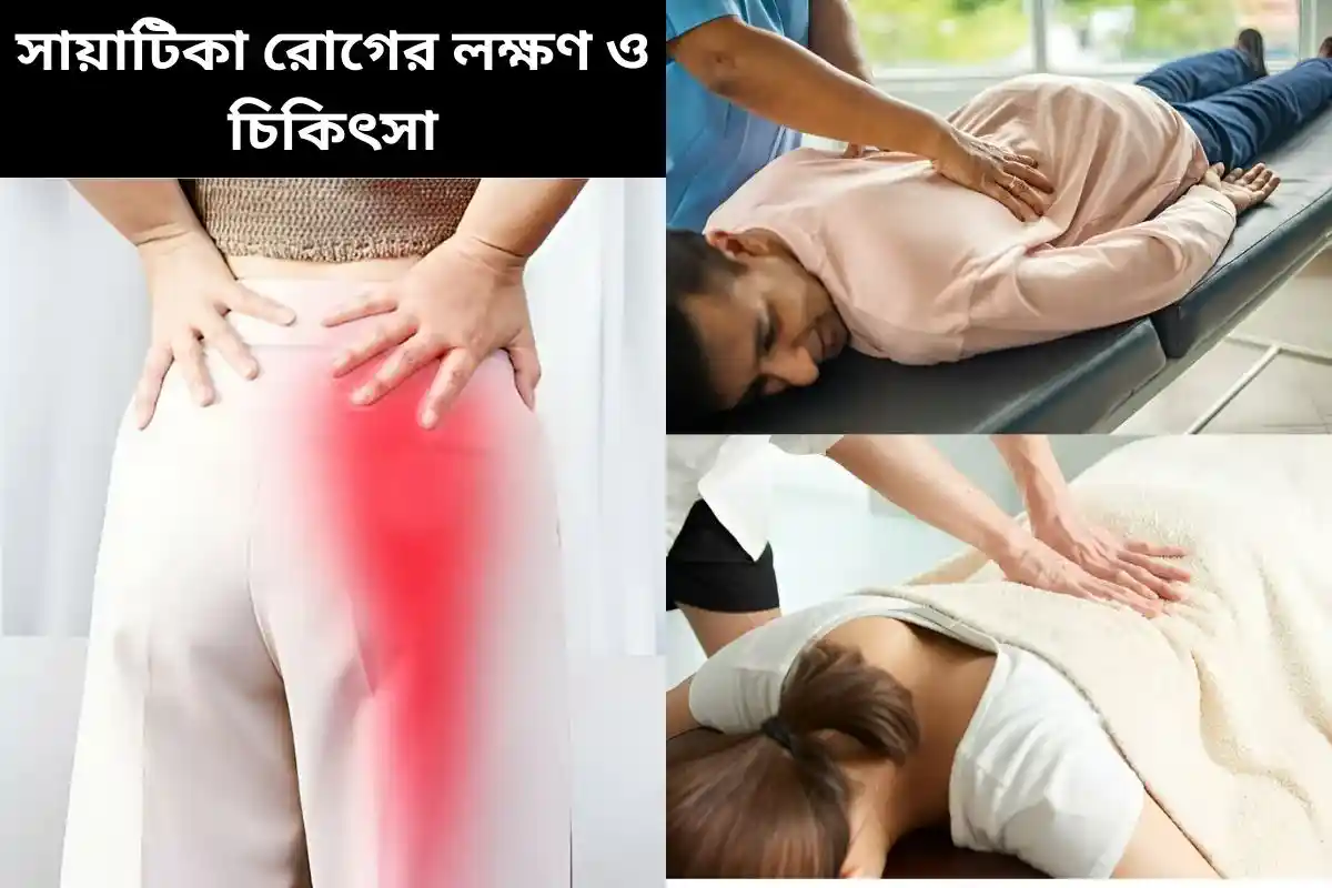 সায়াটিকা রোগের লক্ষণ ও চিকিৎসা