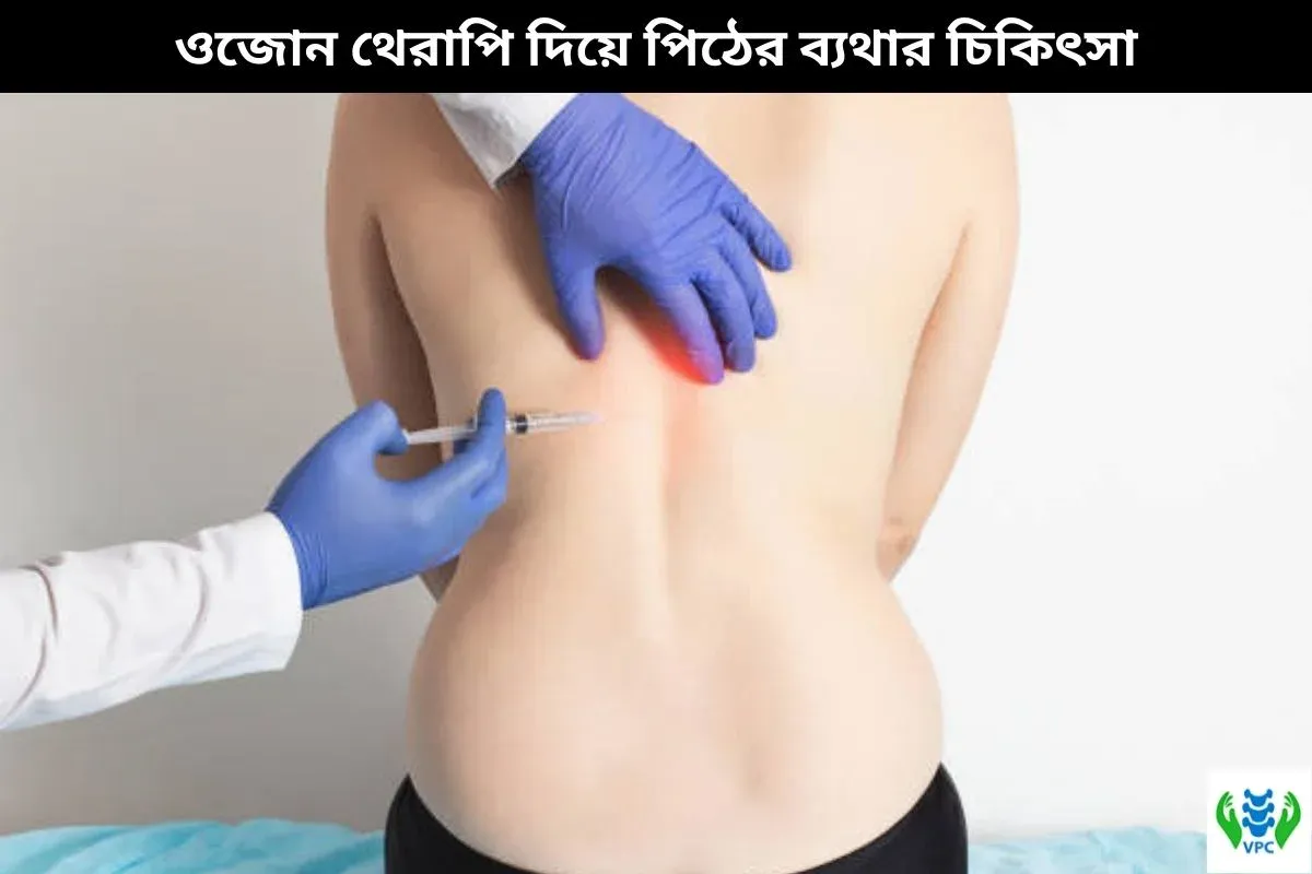 ওজোন থেরাপি দিয়ে পিঠের ব্যথার চিকিৎসা