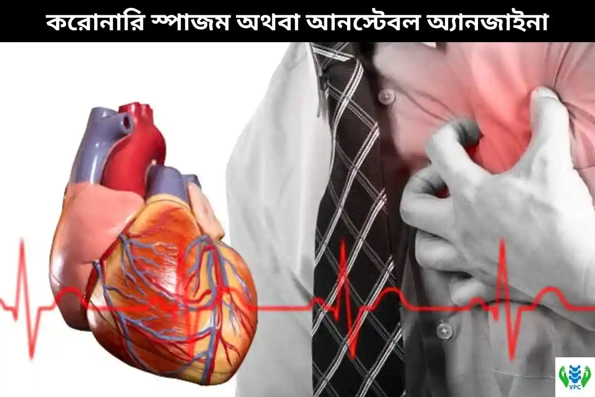 করোনারি স্পাজম অথবা আনস্টেবল অ্যানজাইনা