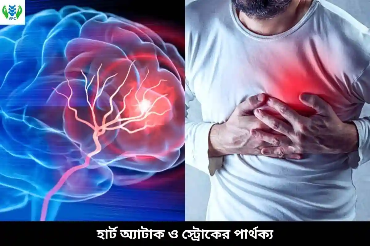 হার্ট অ্যাটাক ও স্ট্রোকের পার্থক্য