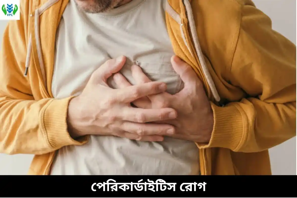 পেরিকার্ডাইটিস রোগ