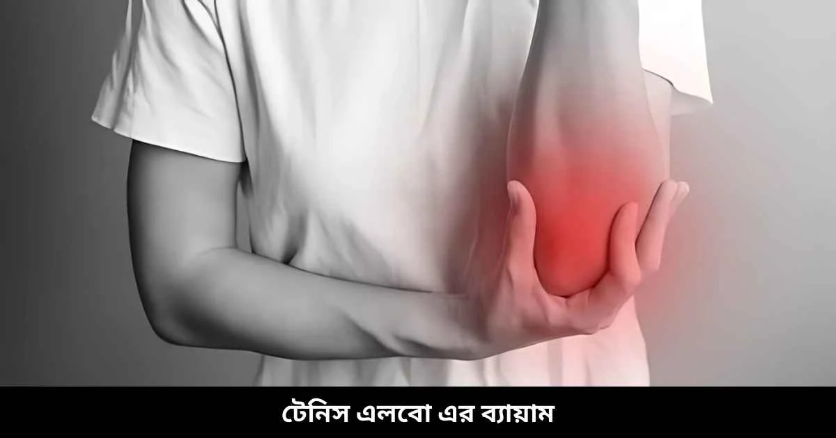 টেনিস এলবো এর ব্যায়াম