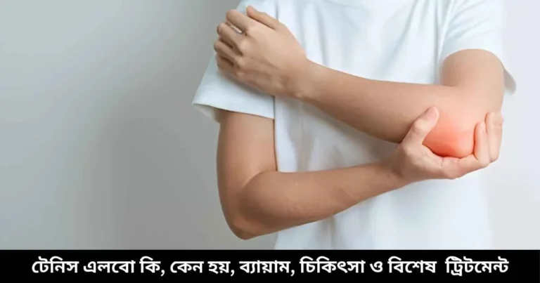 টেনিস এলবো কি, কেন হয়, ব্যায়াম ও বিশেষ চিকিৎসা