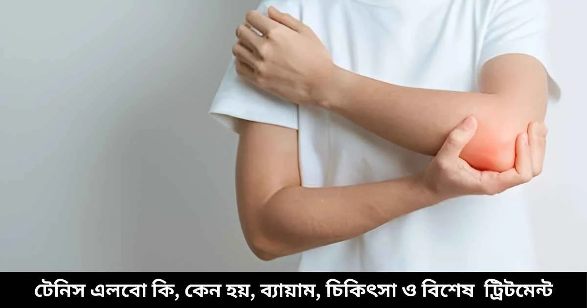 টেনিস এলবো কি, কেন হয়, ব্যায়াম ও বিশেষ চিকিৎসা